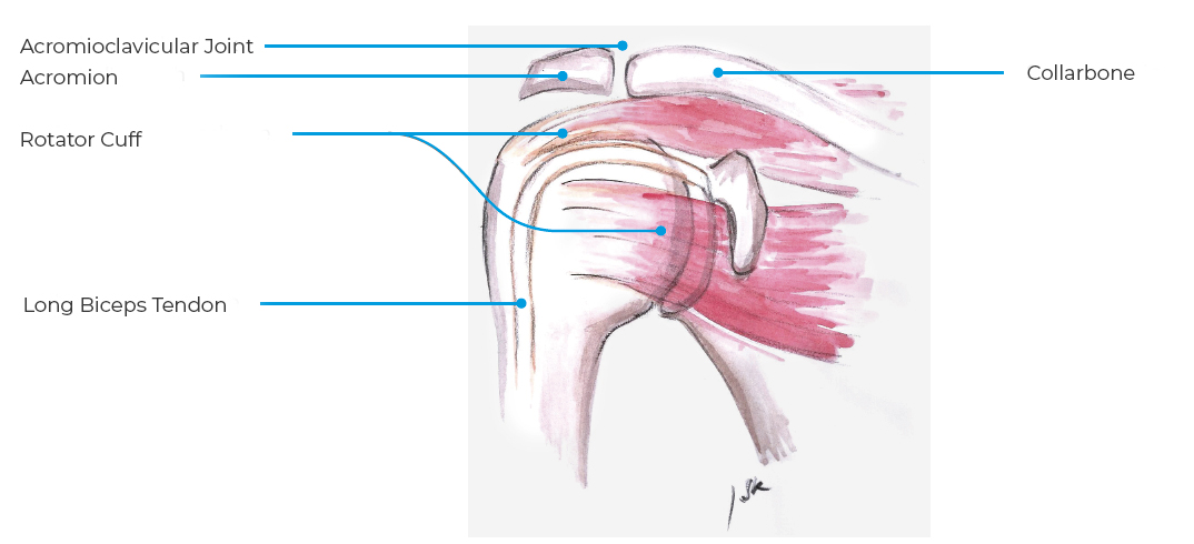 Collarbone Shoulder Instability